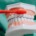 overbrushing, dental cleaning, teeth cleaning, richards bay, dentist near me